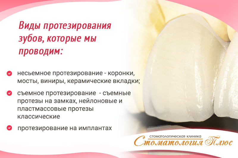 Виды протезирования зубов в Днепре в нашей стоматологии